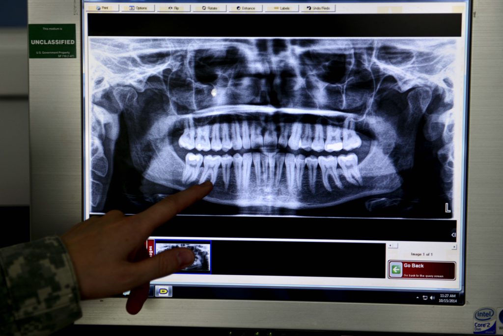 Mennyire káros az ismételt röntgensugárzás?